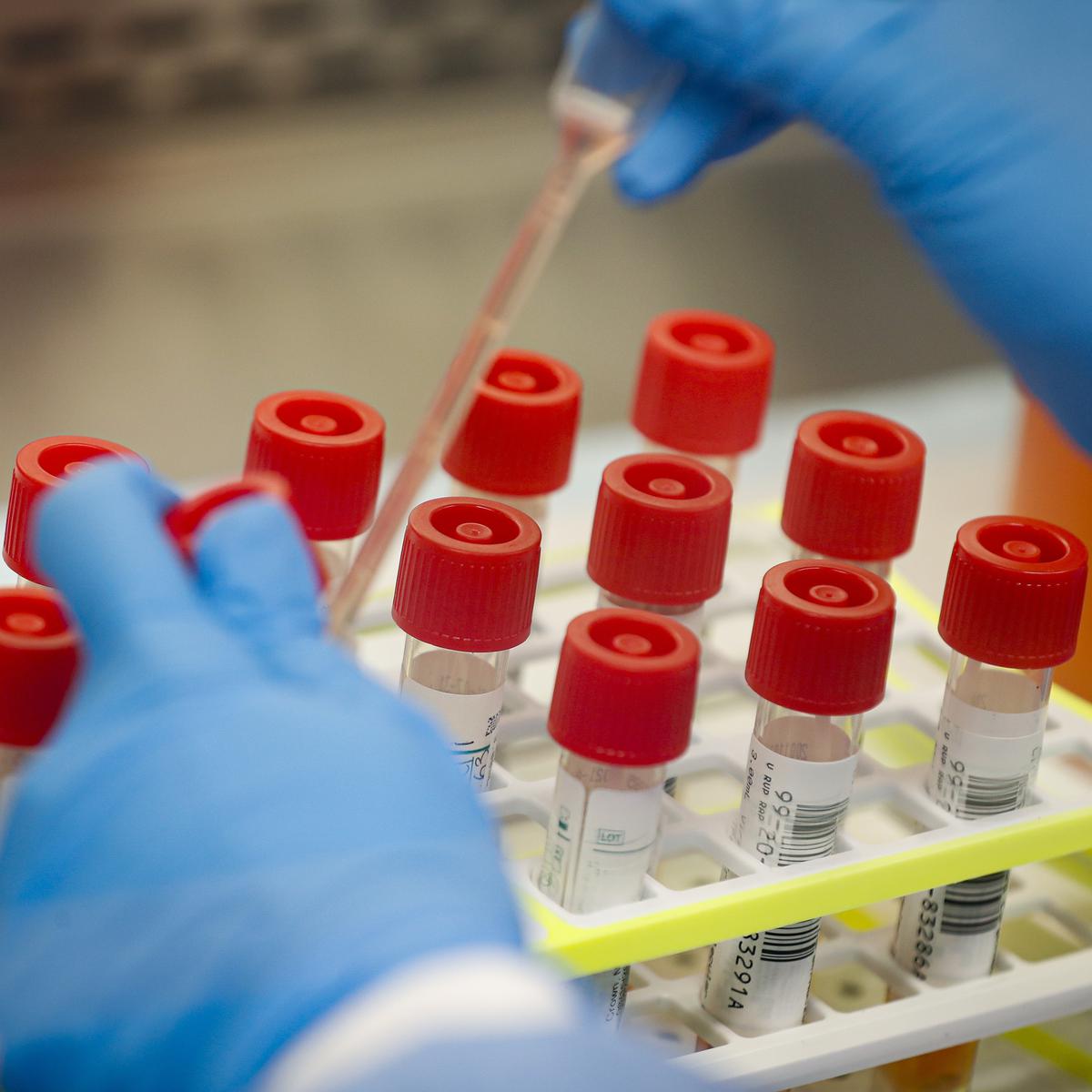 Centre yet to take a call on beginning HPV vaccination campaign for girls