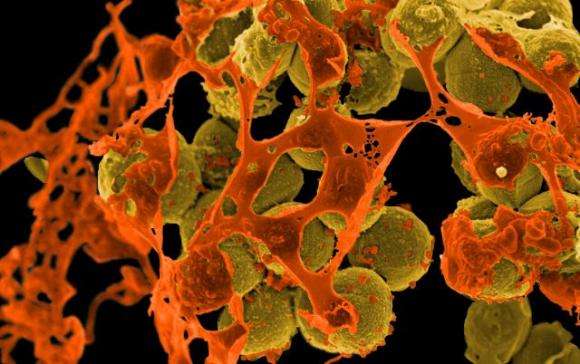 New antibiotic could target drug-resistant bacterium: scientists