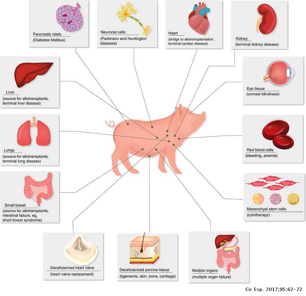 Xenotransplantation - A Medical Breakthrough