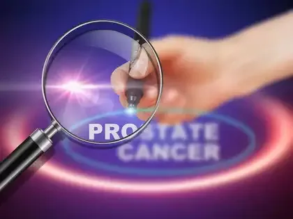 India Launches Pluvicto for Advanced Prostate Cancer Treatment