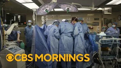 Groundbreaking Pig-to-Human Kidney Transplant: A Medical Milestone